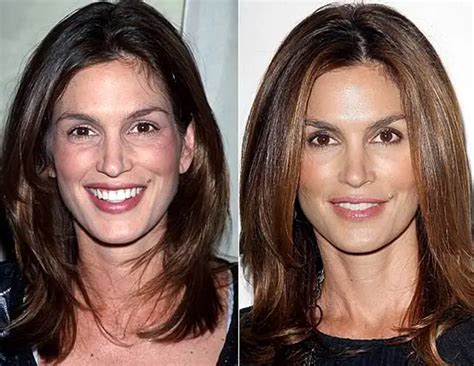 Cindy Crawford Nose Job Plastic Surgery Before and After